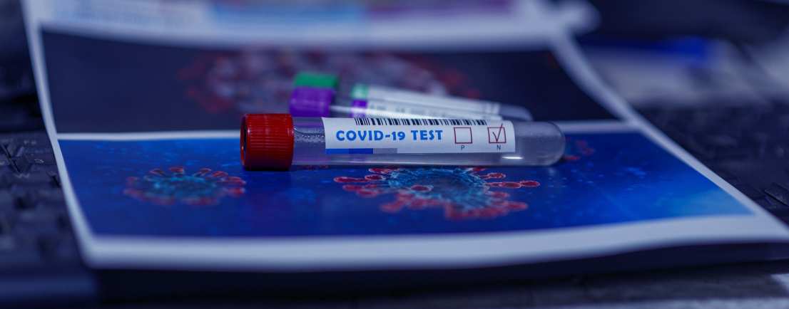Test de coronavirus para entrar en restaurantes